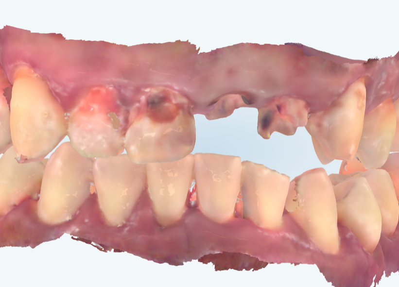 ボロボロ前歯は抜かなきゃダメ？ | ブログ | 市川市の妙典エリアの
