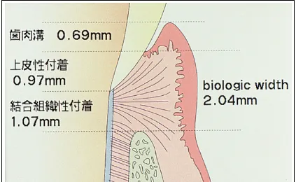 歯茎が下がったら戻らない？？