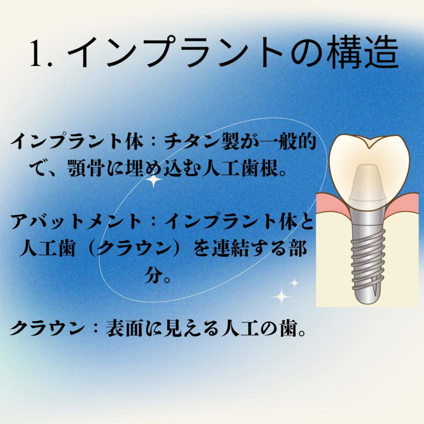 インプラント治療