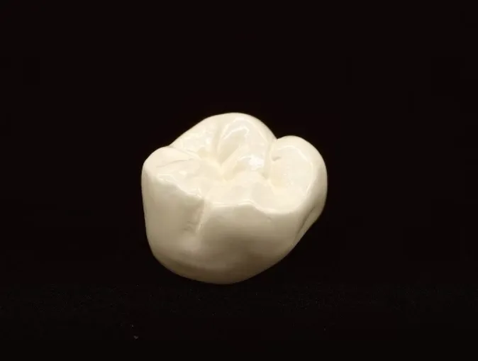 改めて考えるPEEK冠とは？